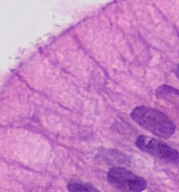 Histology slide (H&E stain) showing curved Helicobacter pylori organisms at the luminal surface of gastric mucosa.