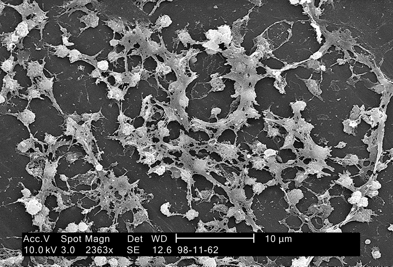 Scanning electron micrograph showing numerous round Staphylococcus aureus bacteria embedded in a sticky biofilm on the surface of an indwelling catheter.