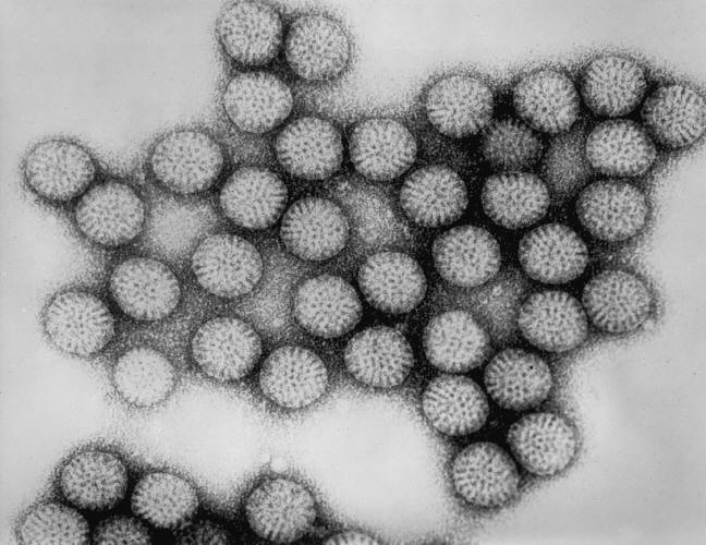 Transmission electron micrograph showing rotavirus particles with their characteristic wheel-like appearance.
