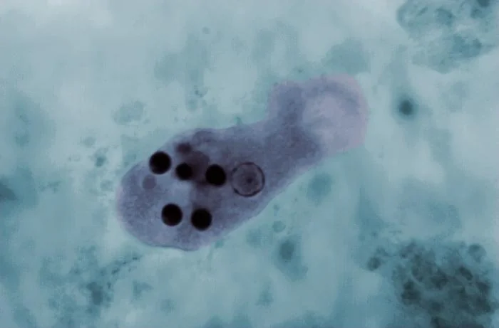 Light micrograph of Entamoeba histolytica trophozoites, showing ingested red blood cells within the parasite cytoplasm.