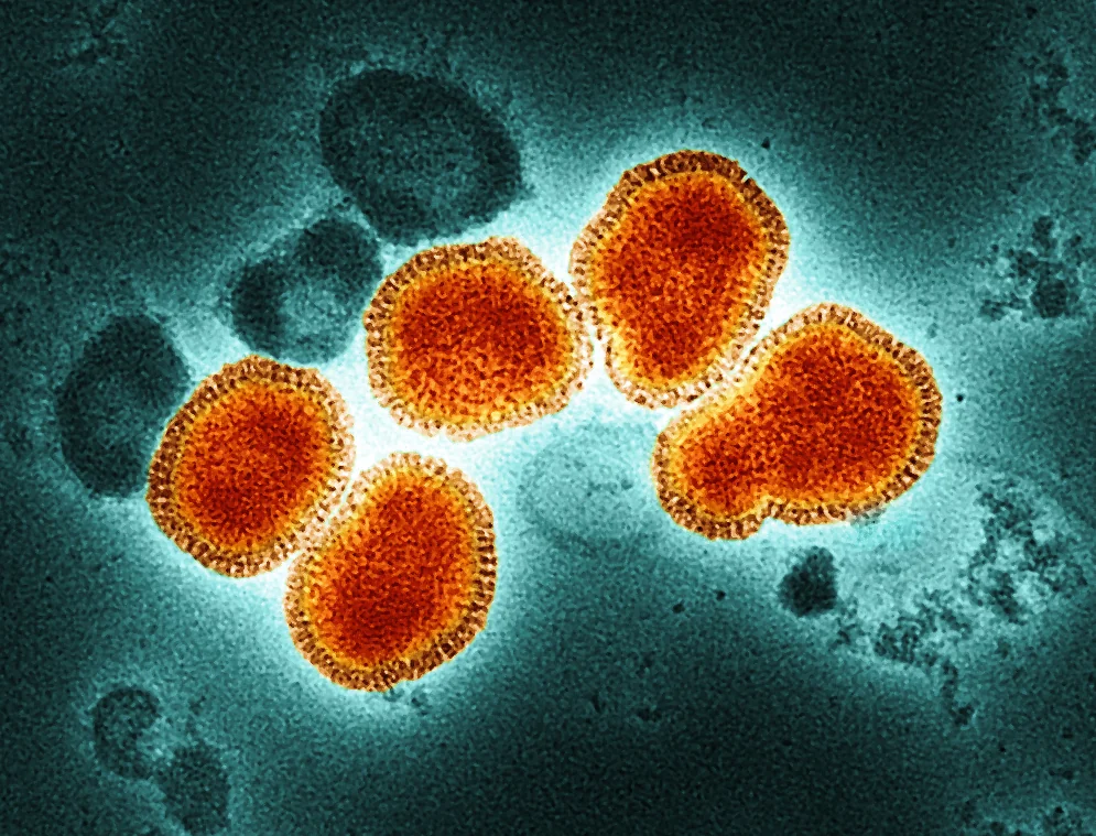 Colourised transmission electron micrograph showing spherical influenza A virus particles.