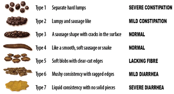The Bristol Stool Chart, illustrating the seven types of stool form from separate hard lumps through to entirely liquid.