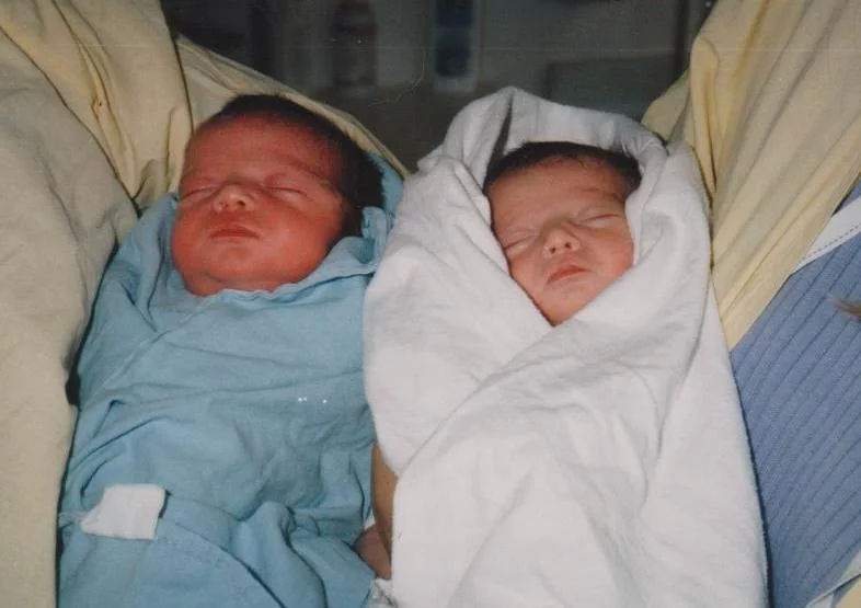 Photograph of newborn twins affected by twin-to-twin transfusion syndrome, one plethoric and red, the other pale.