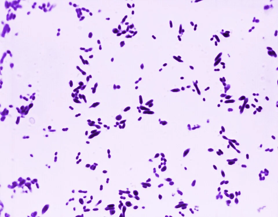 Light micrograph of a Gram stain showing numerous deep purple, oval, lancet-shaped bacteria arranged predominantly in pairs on a pale background.
