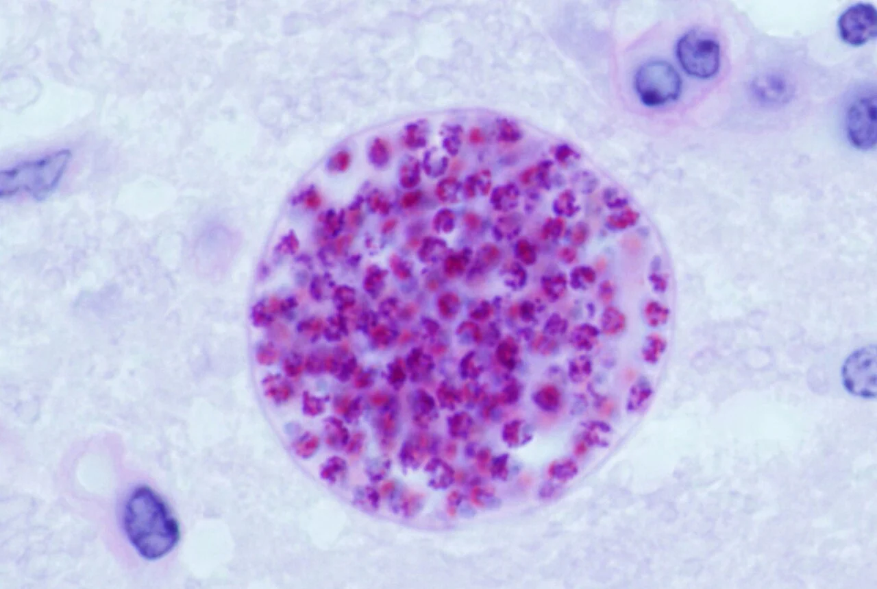Microscopy image showing a Toxoplasma gondii tissue cyst containing numerous stained parasites within brain tissue.